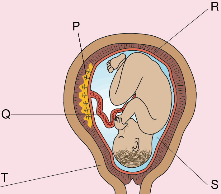 Foetus in the uterus with five structures labelled P, Q, R, S and T; P is a spongy structure on the uterine wall